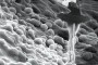 Microscopía electrónica del canal medular del hueso de un conejo, con inserción digital de una foto de la prima ballerina assoluta Alicia Alonso