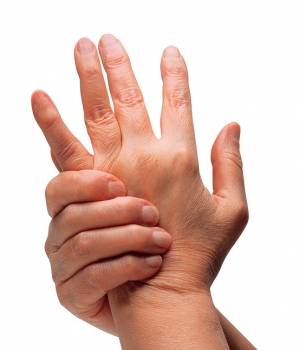 artritis