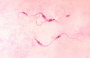 Tema 197. Trypanosoma cruzi